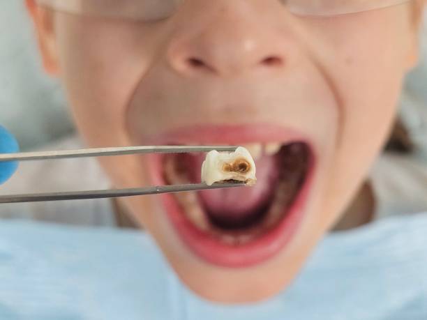 Best Emergency Pediatric Dentist  in Two Rivers, WI