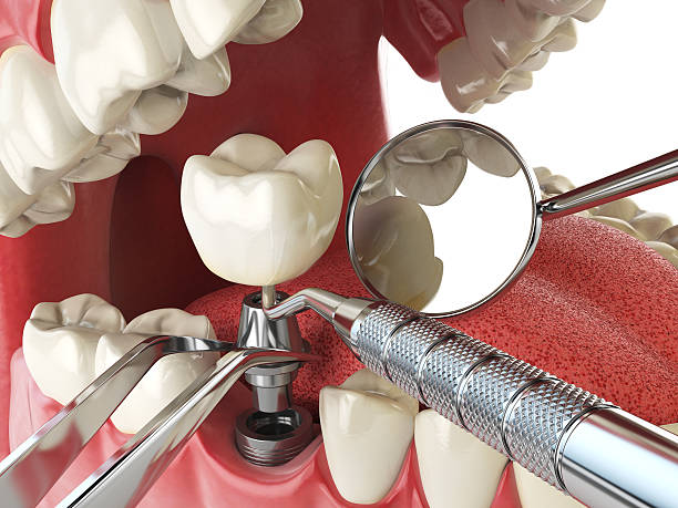 Best Tooth Infection Emergency Dentist  in Two Rivers, WI